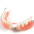 Removable-Partial-Dentures